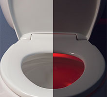Affinity toilet seat